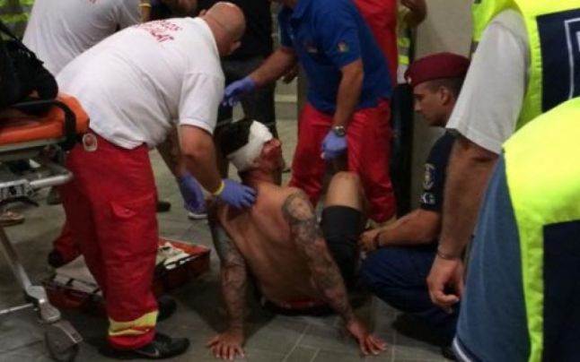 Conflict sângeros între două clanuri de romi din Craiova. Un bărbat a ajuns la spital cu nasul tăiat.